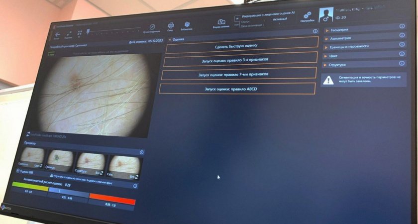 В Рязанском онкодиспансере с помощью системы искусственного интеллекта обследовали уже 50 пациентов