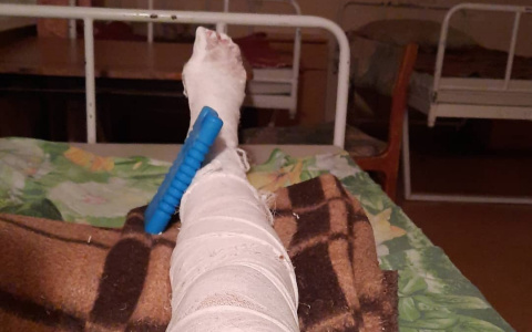 В Рязани беременная девушка выходила из маршрутки и сломала ногу