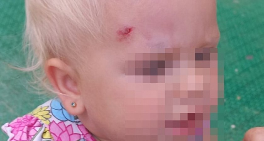 В Рязани на детской площадке на улице Семчинской ребенок едва не лишился глаза