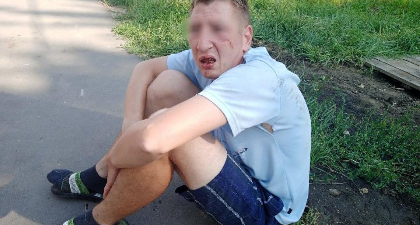 В Ряжске 11 августа трое подростков избили 35-летнего инвалида детства и его мать