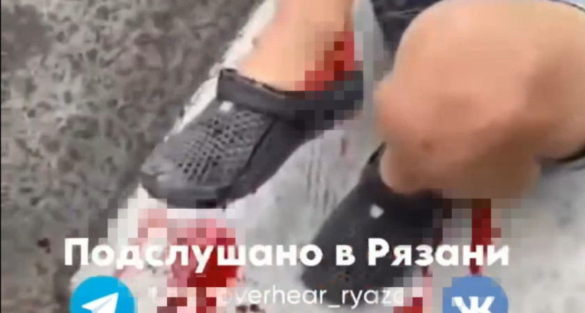 В Рязани на Лыбедском бульваре ребенок получил перелом ноги