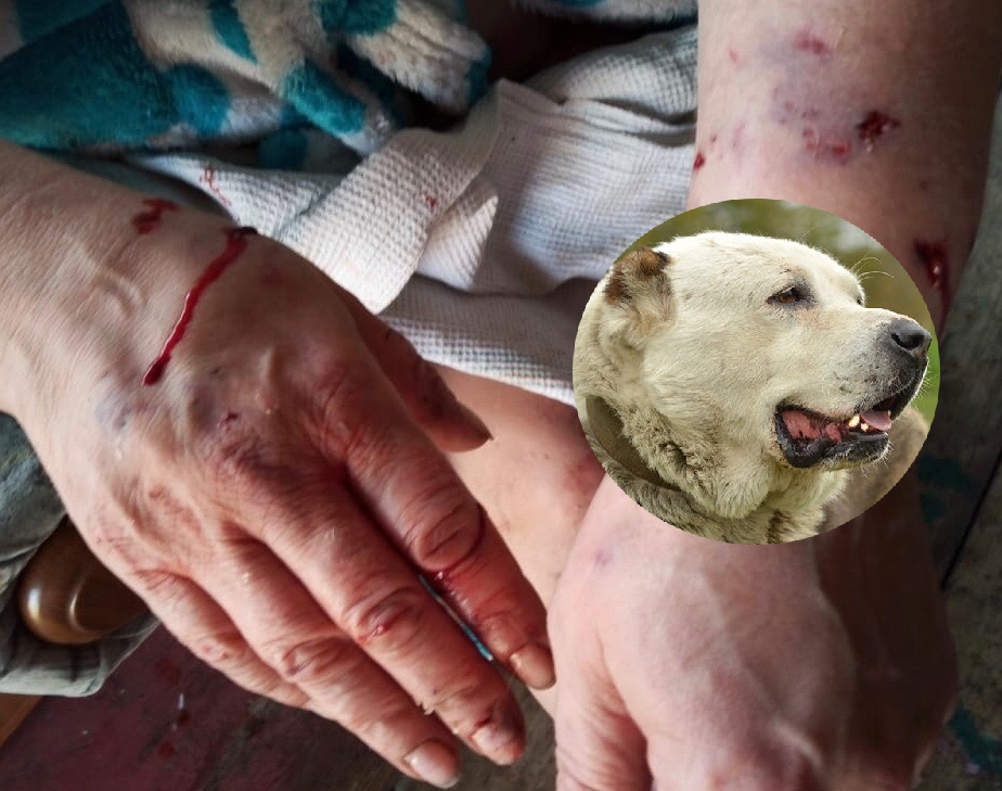 "Собака набросилась на нее и пыталась впиться в шею" - женщина, которая стала свидетелем нападения алабая в Полянах