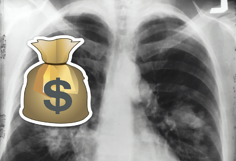 Врачи с "непонятным" статусом: рязанские рентгенологи пытаются добиться "коронавирусных" выплат