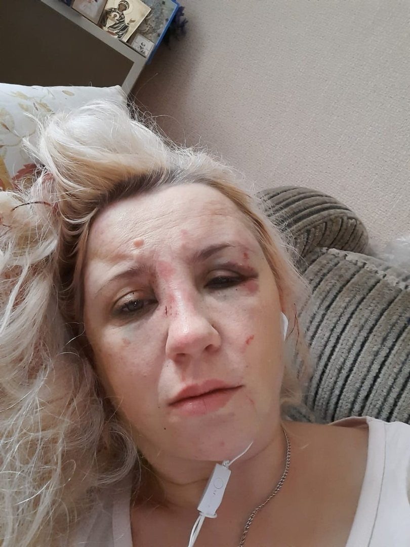 Пинали по голове: маму известного рязанского блоггера зверски избили в центре города