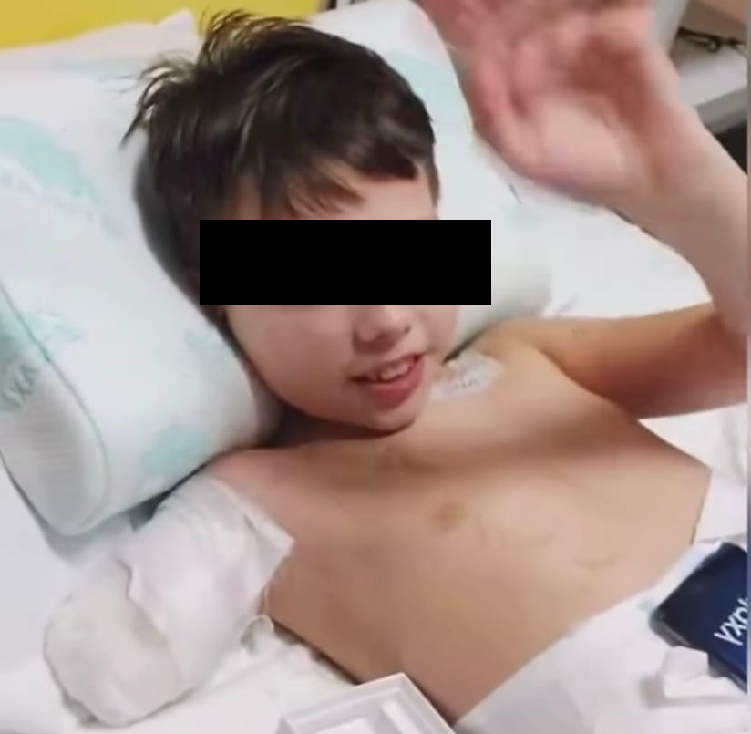 Потерял руку и обе ноги: мама пострадавшего ребенка показала его после аварии