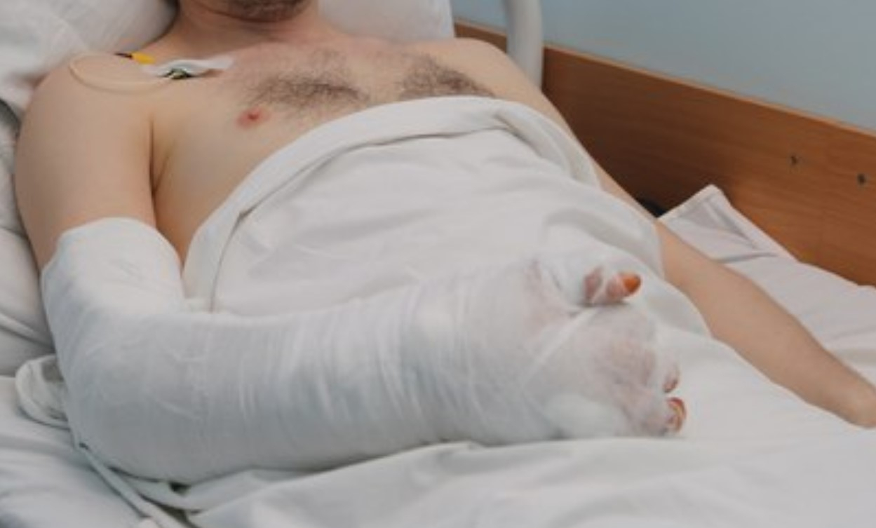 Собрали по кусочкам: травматологи восстановили рязанцу раздробленную руку