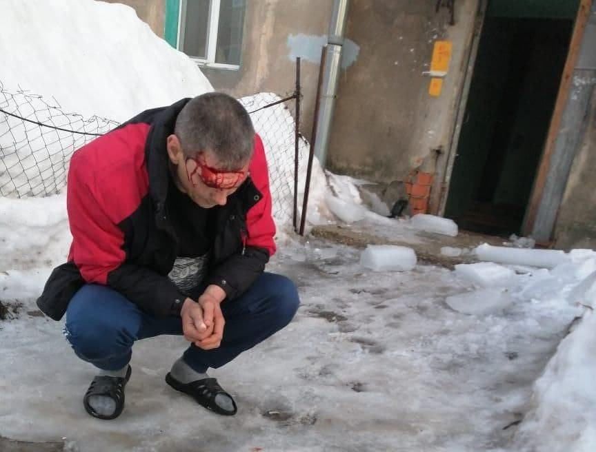 2 инцидента за день: прокуратура проведет проверку после падения ледяных глыб на людей