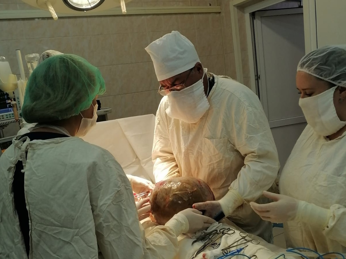 Затянула: рязанские хирурги вырезали у пациентки 8-килограммовую опухоль