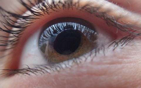 Не трогай глаза: рязанские врачи предупредили о высоком риске заражения конъюнктивитом